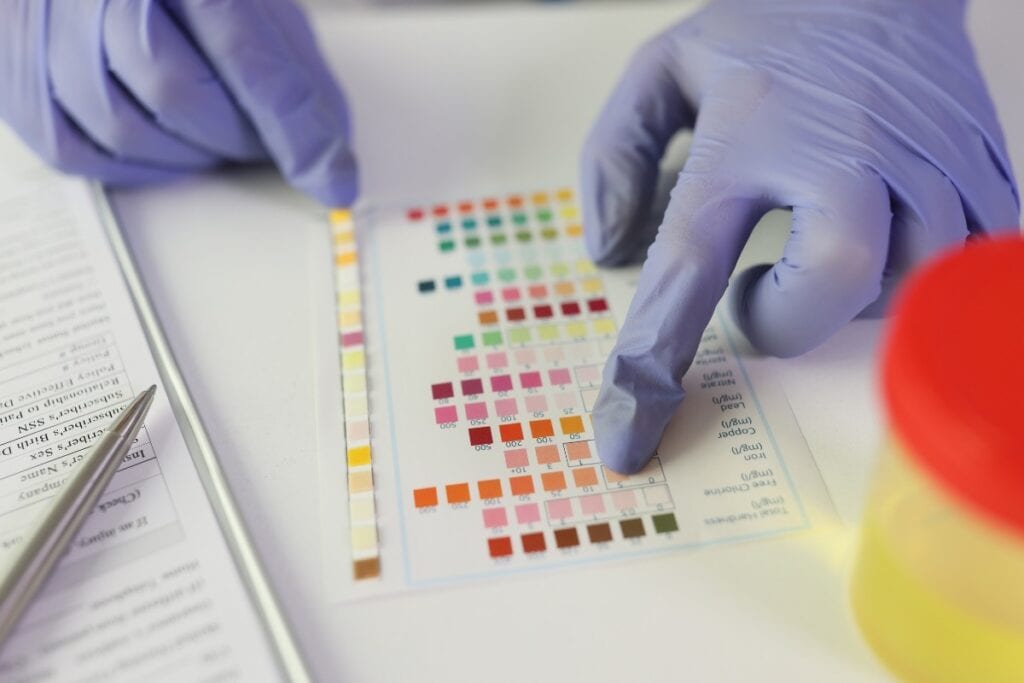 Lab technician analyzing urine test strips results.